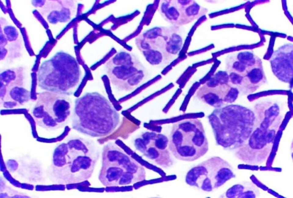 coloração-gram-antraz_dr