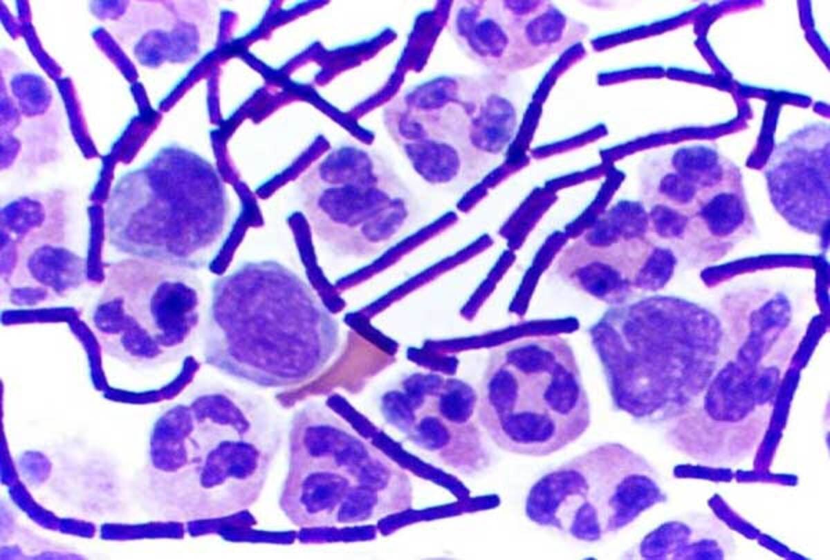 coloração-gram-antraz_dr