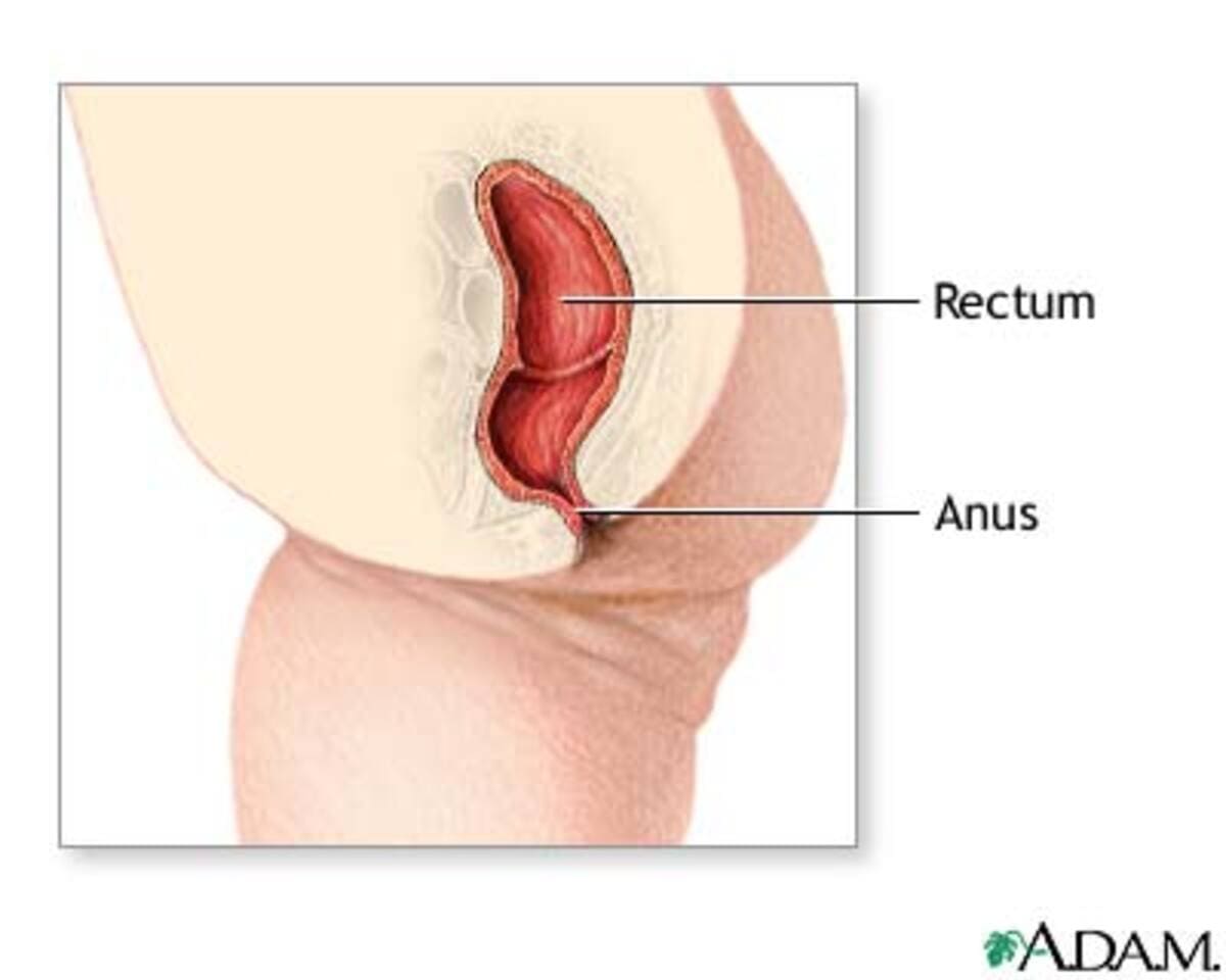 incontinência fecal 